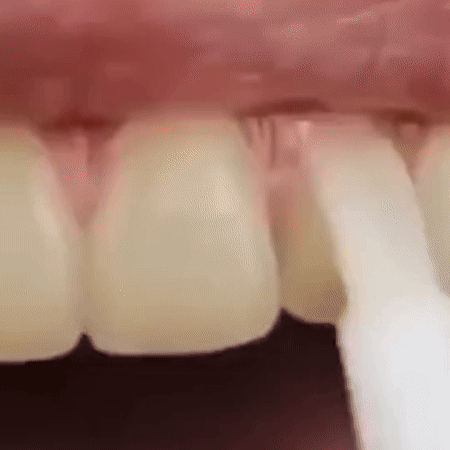 Blanqueador Dental Portátil