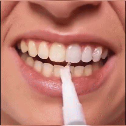 Blanqueador Dental Portátil