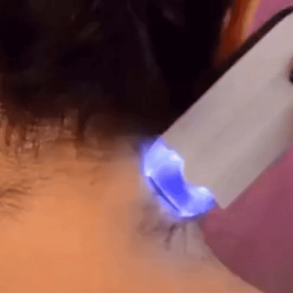 Depiladora Mágica Sin Dolor