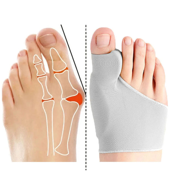 Calcetines Correctores de Juanetes